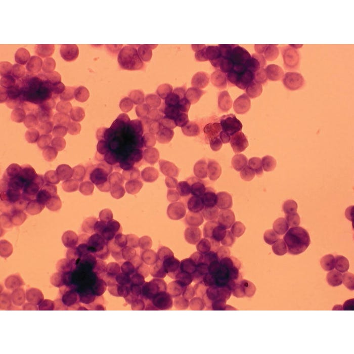 Edvotek Morphology of Cancer Cells Kit